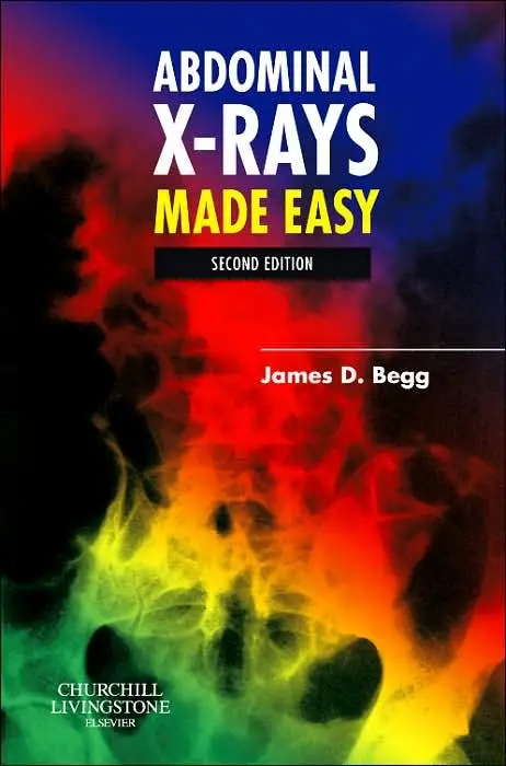 Abdominal X-Rays Made Easy, 2nd Edition, International Edition