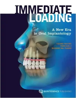 Immediate Loading: A New Era in Oral Implantology