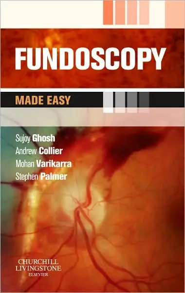 Fundoscopy Made Easy, International Edition
