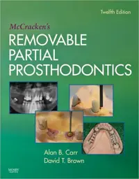 McCracken's Removable Partial Prosthodontics, Edition 12