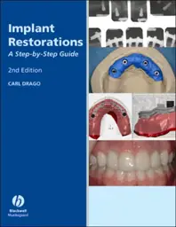 Implant Restoration Solutions: A Step-by-Step Guide, Edition 22