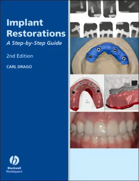 Implant Restoration Solutions: A Step-by-Step Guide, Edition 22
