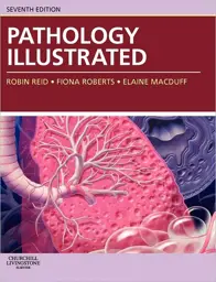 Pathology Illustrated, International Edition, 7th Edition