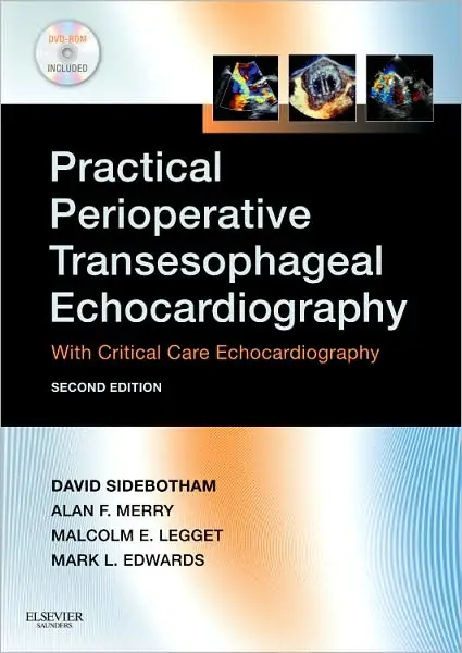 Practical Perioperative Transesophageal Echocardiography, 2nd Edition: : With Critical Care Echocardiography [With DVD ROM]