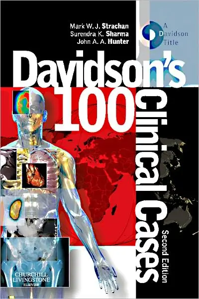 Davidson's 100 Clinical Cases, International Edition, 2nd Edition