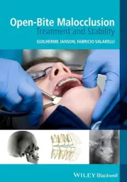 Open-Bite Malocclusion: Treatment and Stability