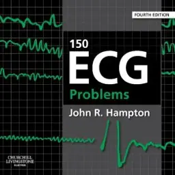 150 ECG Problems, International Edition, 4th Edition