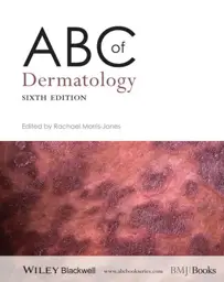 ABC of Dermatology, 6th Edition