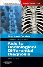 Chapman & Nakielny's Aids to Radiological Differential Diagnosis: Expert Consult - Online and Print, 6th Edition