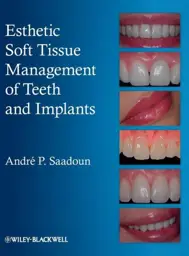 Esthetic Soft Tissue Management of Teeth and Implants