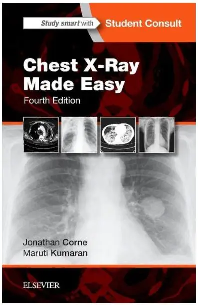 Chest X-Ray Made Easy, International Edition, 4th Edition
