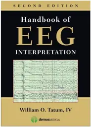 Handbook of EEG Interpretation, 2nd Ed