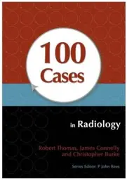 100 Cases in Radiology, 1st Edition
