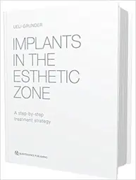Implants in the Esthetic Zone: A Step-by-Step Treatment Strategy, 1st Edition
