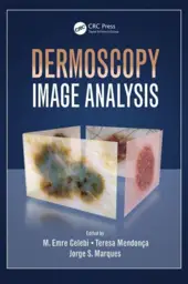 Dermoscopy Image Analysis