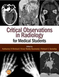 Critical Observations in Radiology for Medical Students, 1st Edition