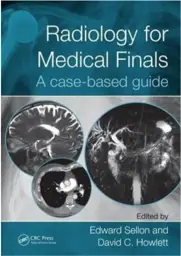 Radiology for Medical Finals: A case-based guide, 1st Edition