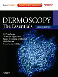 Dermoscopy: The Essentials: Expert Consult - Online and Print, 2nd Edition