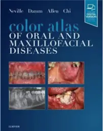 Color Atlas of Oral and Maxillofacial Diseases, 1st Edition