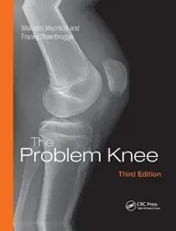 The Problem Knee, 3rd Edition