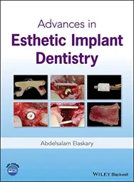 Advances in Esthetic Implant Dentistry, 1st Edition