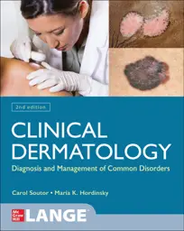 Clinical Dermatology: Diagnosis and Management of Common Disorders