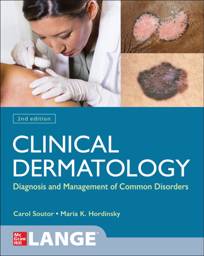 Clinical Dermatology: Diagnosis and Management of Common Disorders