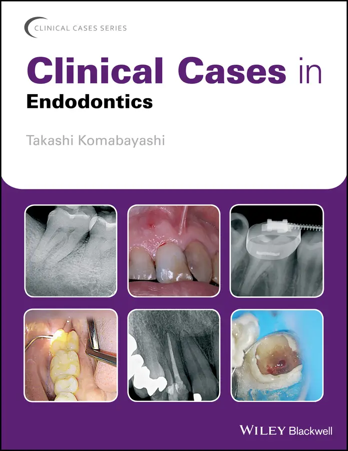 Clinical Cases in Endodontics, 1st Edition