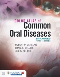 Color Atlas of Common Oral Diseases