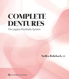 Complete Dentures: The Legacy Prosthetic System