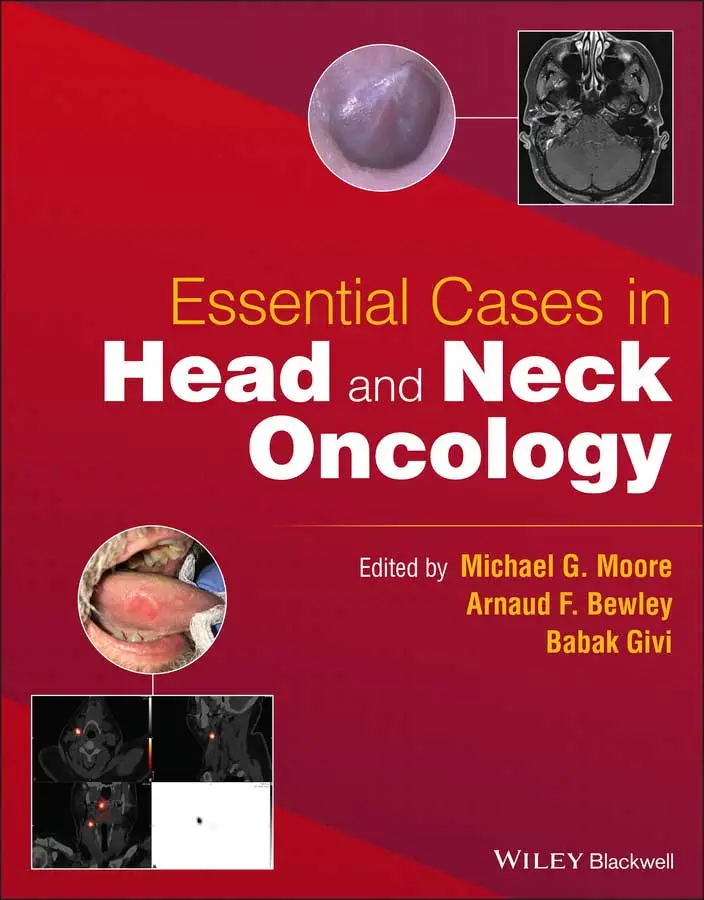 Essential Cases in Head and Neck Oncology 1st Edition