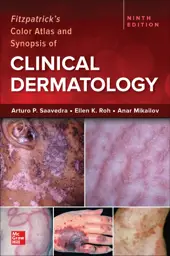 Fitzpatrick's Color Atlas and Synopsis of Clinical Dermatology