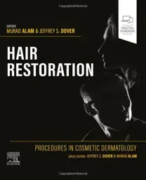 Procedures in Cosmetic Dermatology: Hair Restoration