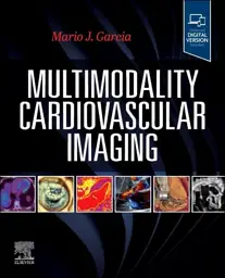 Multimodality Cardiovascular Imaging, 1st Edition