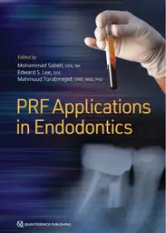 PRF-Applications-in-Endodontics-9780867158274